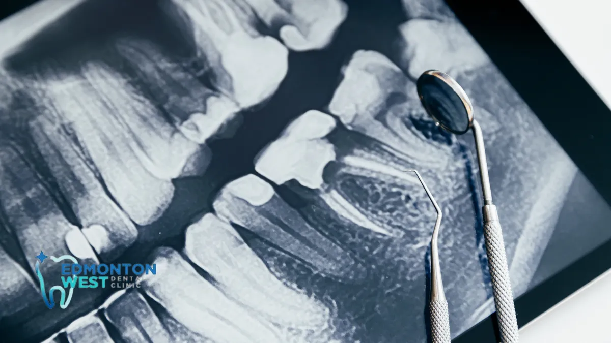 Benefits of Digital X-Rays Over Traditional X-Rays in Dental Care