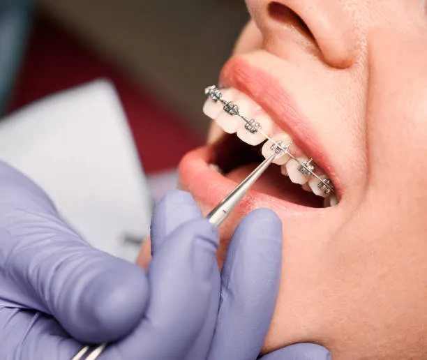 Early Orthodontic Treatment