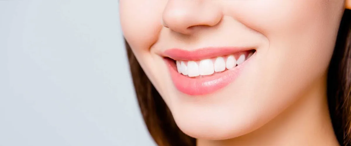 How Long Do Veneers Last?