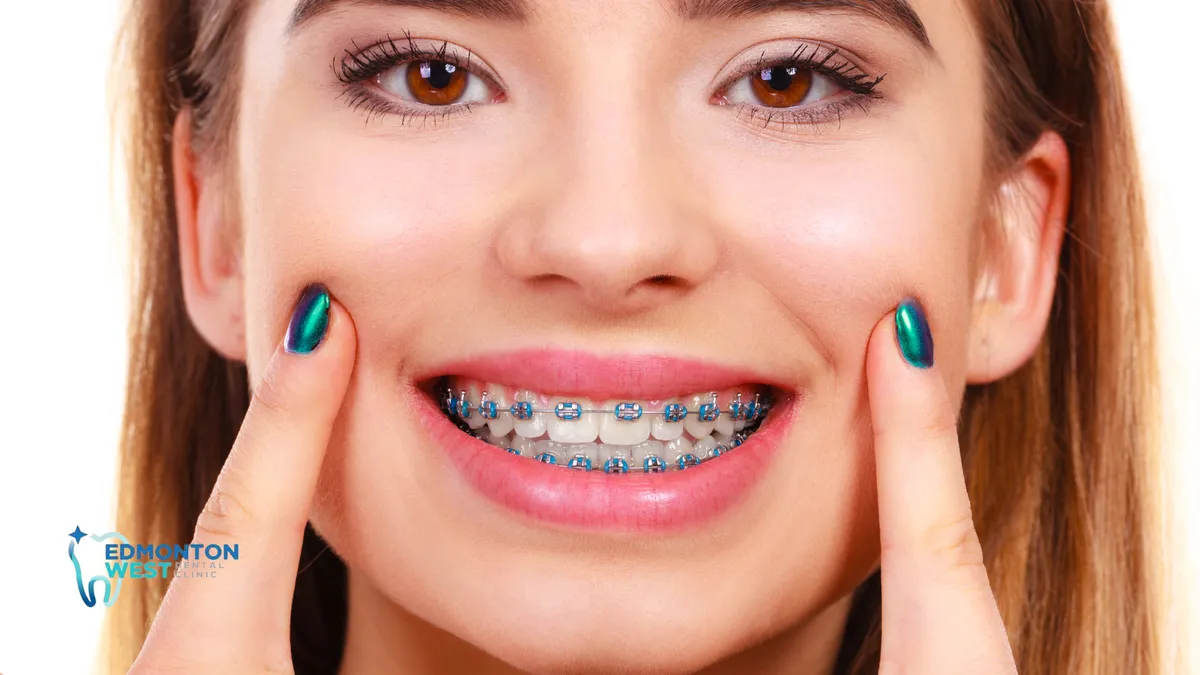 Differences Between Braces for Adults and Teens