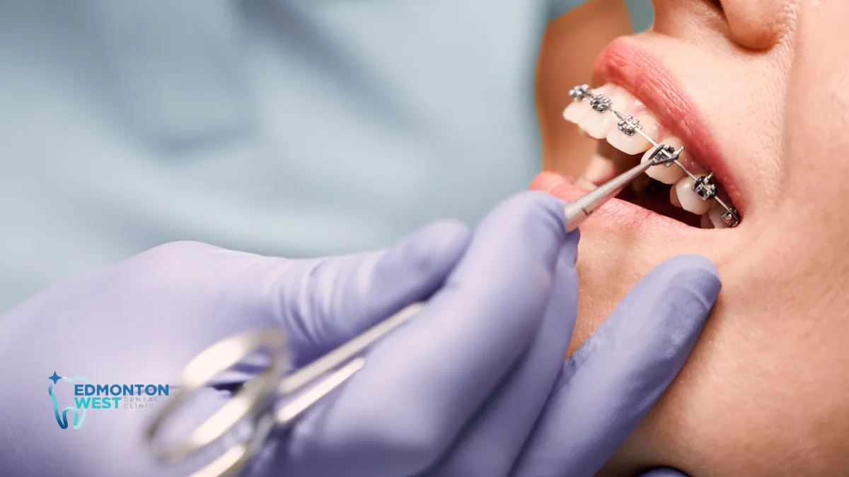 How Malocclusion Affects Speech in Adults and Kids