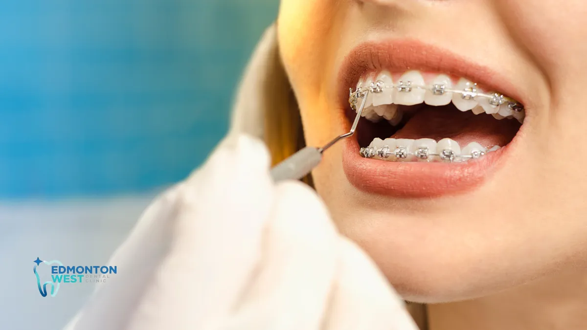 How Orthodontics Can Improve Overall Oral Health